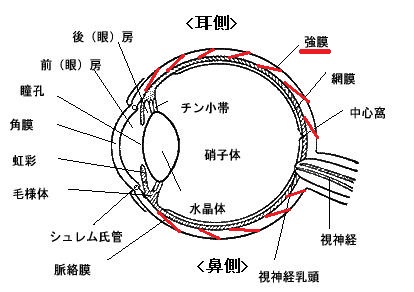 強膜炎と上強膜炎 広辻眼科